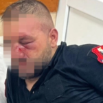 Policia e Shtetit: 14 efektivë të plagosur gjatë protestës, 35 persona të shoqëruar